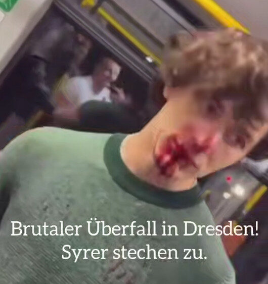 MesserSyrerDresdenjpg